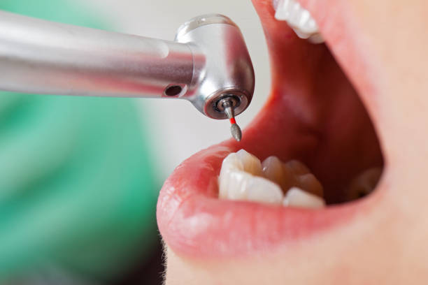 Trusted OH Emergency Dental Service Experts